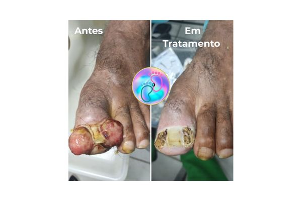 Foto de antes e depois do tratamento 28